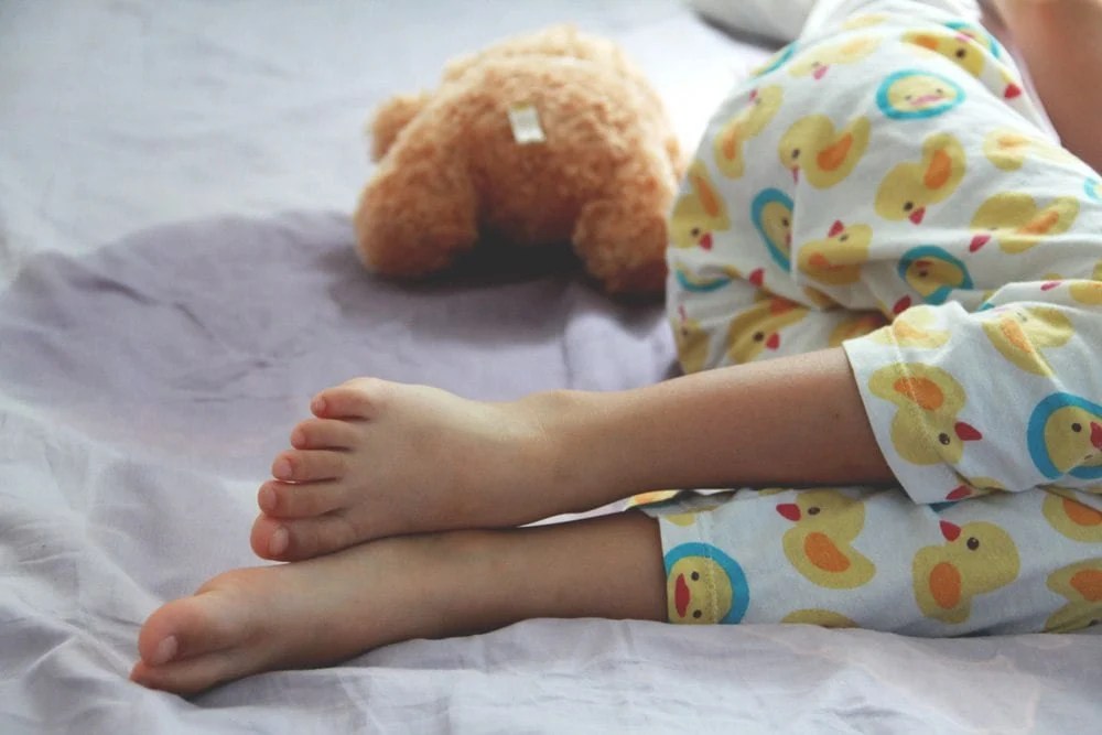 Enuresis (Bed Wetting) in Children Common Causes and Reasons